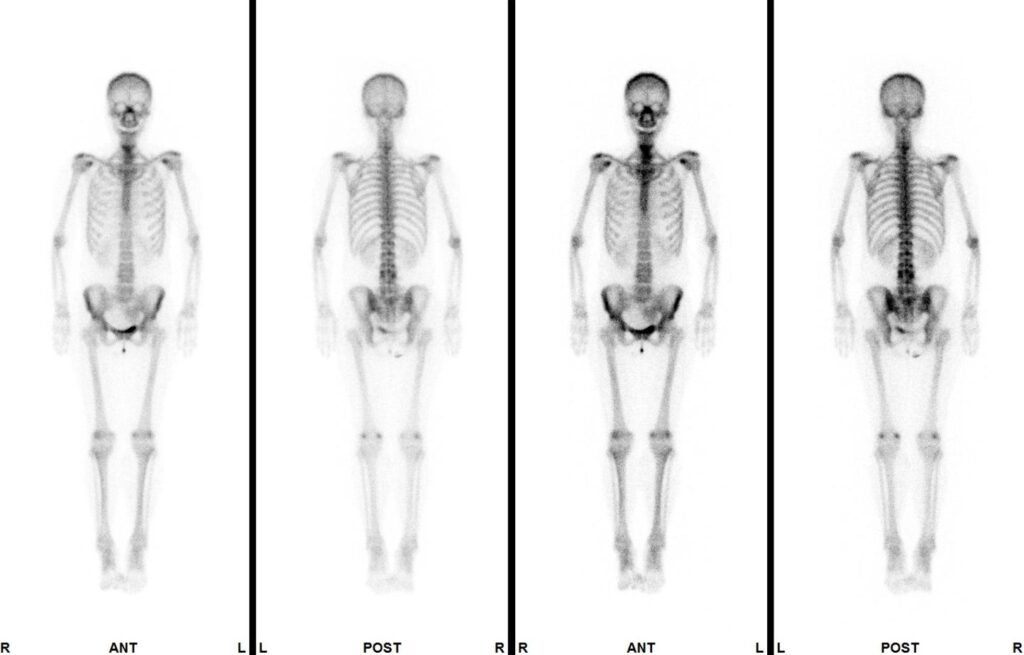 薬品が臓器に取り込まれる様子や分布を画像化・データ化することで臓器の機能や病変の広がりを確認することができる装置です。