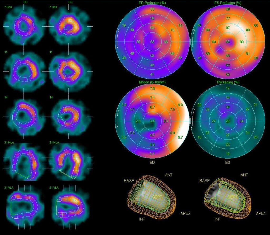 薬品が臓器に取り込まれる様子や分布を画像化・データ化することで臓器の機能や病変の広がりを確認することができる装置です。