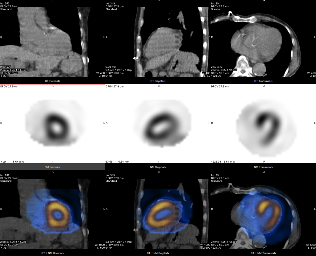 薬品が臓器に取り込まれる様子や分布を画像化・データ化することで臓器の機能や病変の広がりを確認することができる装置です。