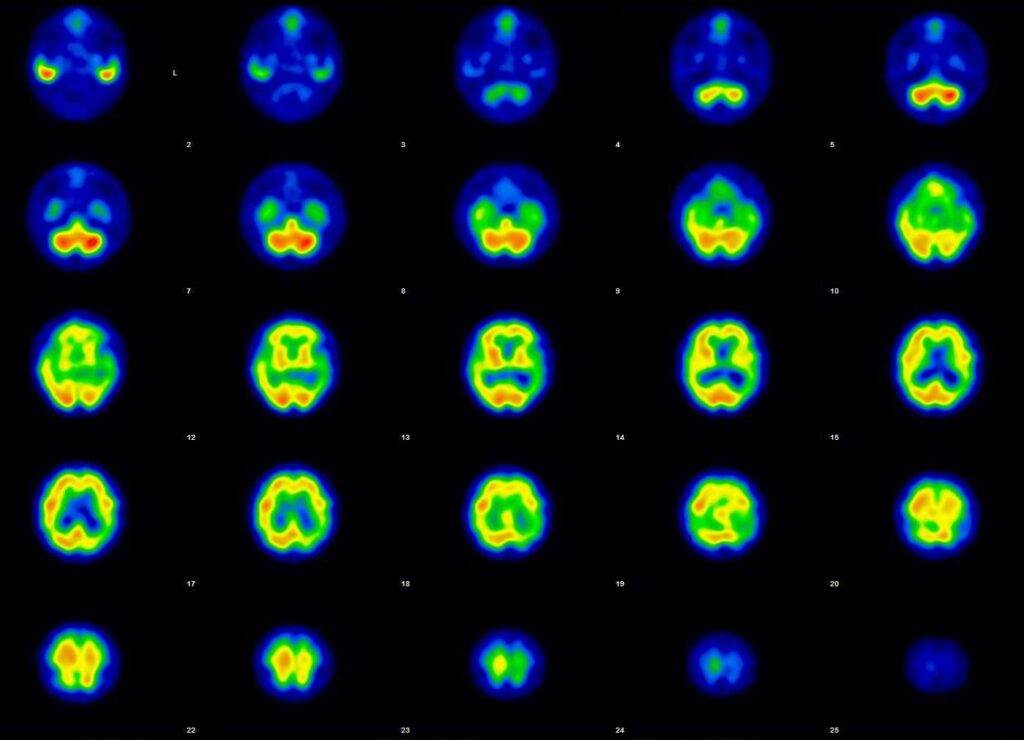 薬品が臓器に取り込まれる様子や分布を画像化・データ化することで臓器の機能や病変の広がりを確認することができる装置です。